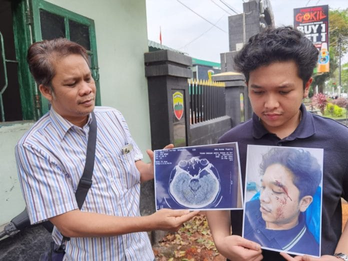 Aksi Brutal Taruna Akmil Diduga Pukuli Mahasiswa di Medan Hingga Babak Belur